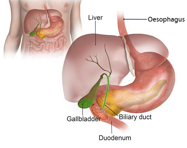 Bile Duct Obstructions