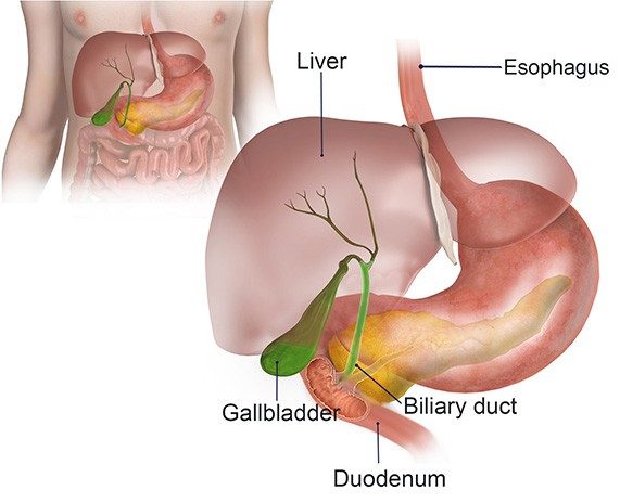 Bile Duct Surgery